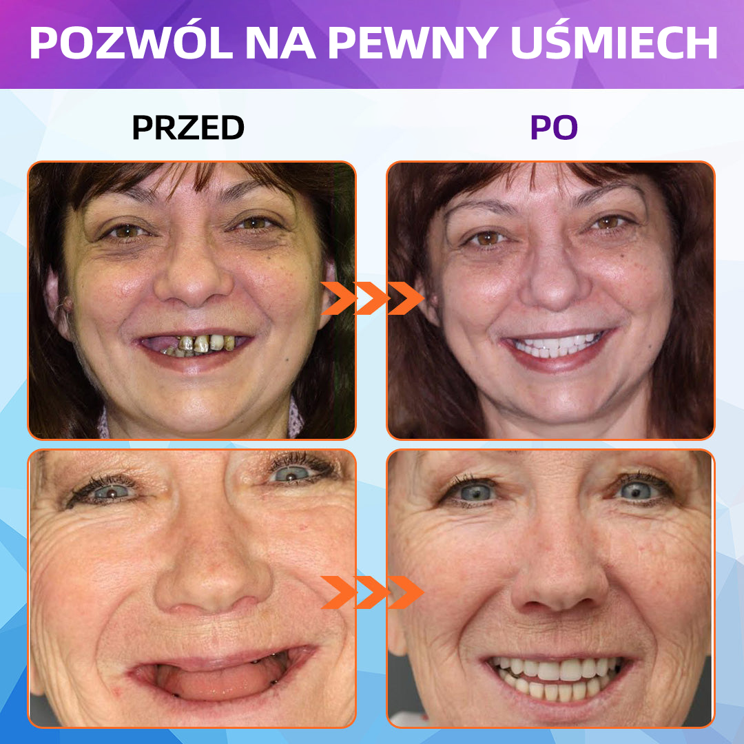 𝐁𝐢𝐤𝐞𝐧𝐝𝐚™ RELINOWANIE SILIKONOWE ZESTAW PROTEZ ( najniższa cena online)💯