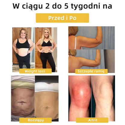 Sprzedaż w ostatnich dniach, rabat 20% WYŁĄCZNIE - ❤️‍🔥𝐶𝑍𝑇𝐼𝐶𝐿𝐸™ Terapeutyczny pierścień magnetyczny limfatyczny z okiem kota💍