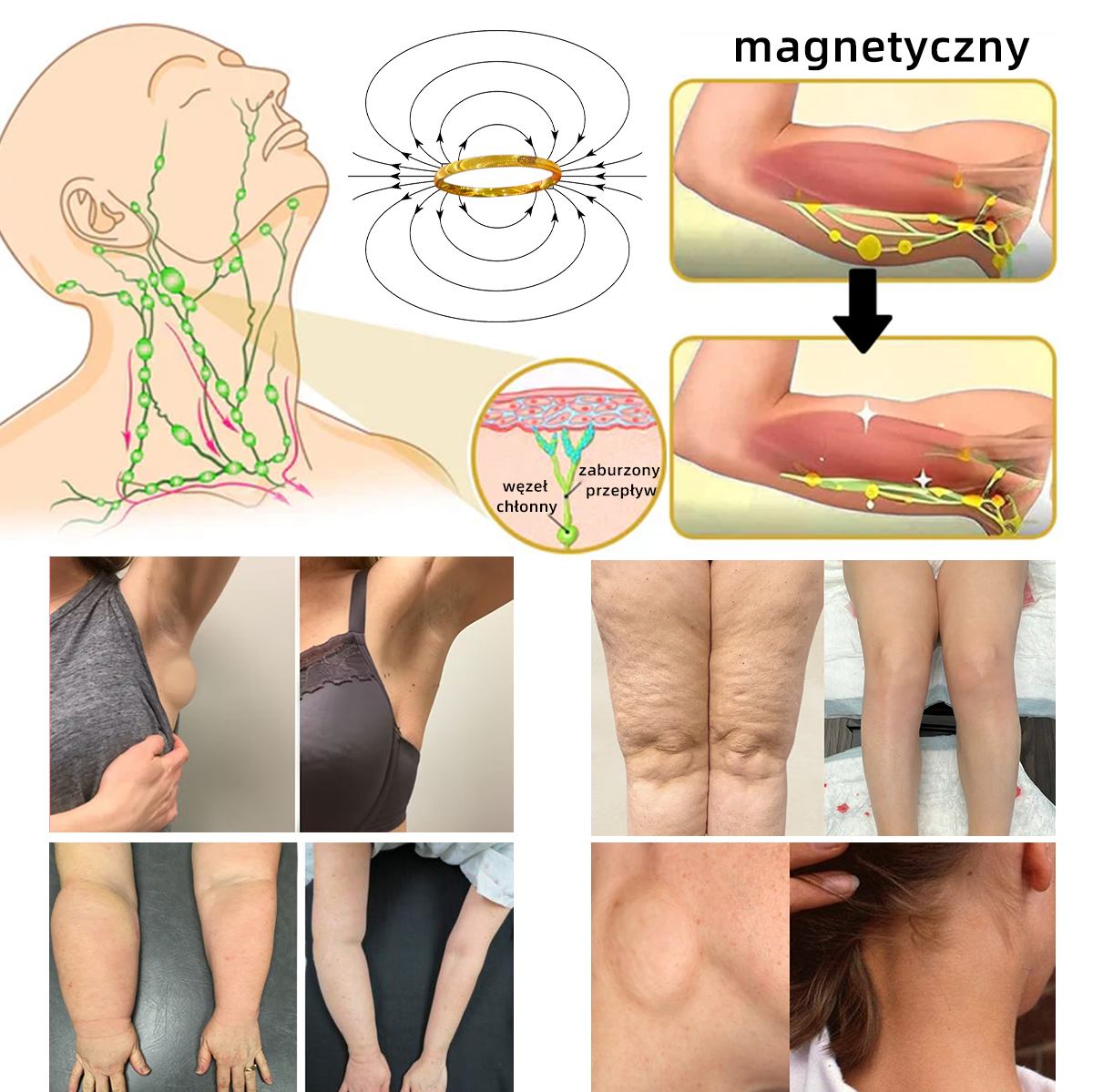 Sprzedaż w ostatnich dniach, rabat 20% WYŁĄCZNIE - ❤️‍🔥𝐶𝑍𝑇𝐼𝐶𝐿𝐸™ Terapeutyczny pierścień magnetyczny limfatyczny z okiem kota💍