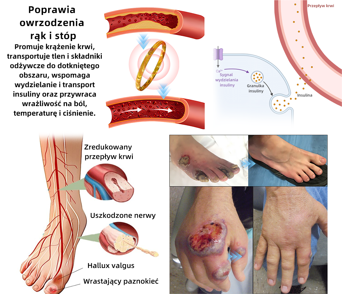 Sprzedaż w ostatnich dniach, rabat 20% WYŁĄCZNIE - ❤️‍🔥𝐶𝑍𝑇𝐼𝐶𝐿𝐸™ Terapeutyczny pierścień magnetyczny limfatyczny z okiem kota💍