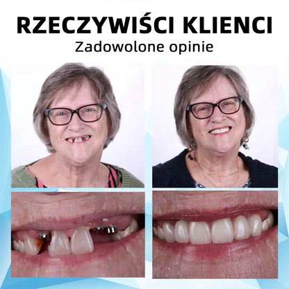 𝐁𝐢𝐤𝐞𝐧𝐝𝐚™🦷𝐙𝐞𝐬𝐭𝐚𝐰 𝐩𝐫𝐨𝐭𝐞𝐳 𝐝𝐞𝐧𝐭𝐲𝐬𝐭𝐲𝐜𝐳𝐧𝐲𝐜𝐡 𝐳 𝐬𝐢𝐥𝐢𝐤𝐨𝐧𝐮 (⏰𝐳𝐧𝐢ż𝐤𝐚 𝐨𝐠𝐫𝐚𝐧𝐢𝐜𝐳𝐨𝐧𝐚 𝐜𝐳𝐚𝐬𝐨𝐰𝐨, 𝐭𝐲𝐥𝐤𝐨 𝐩𝐫𝐳𝐞𝐳 𝟑𝟎 𝐦𝐢𝐧𝐮𝐭👨‍⚕️)👨‍⚕️