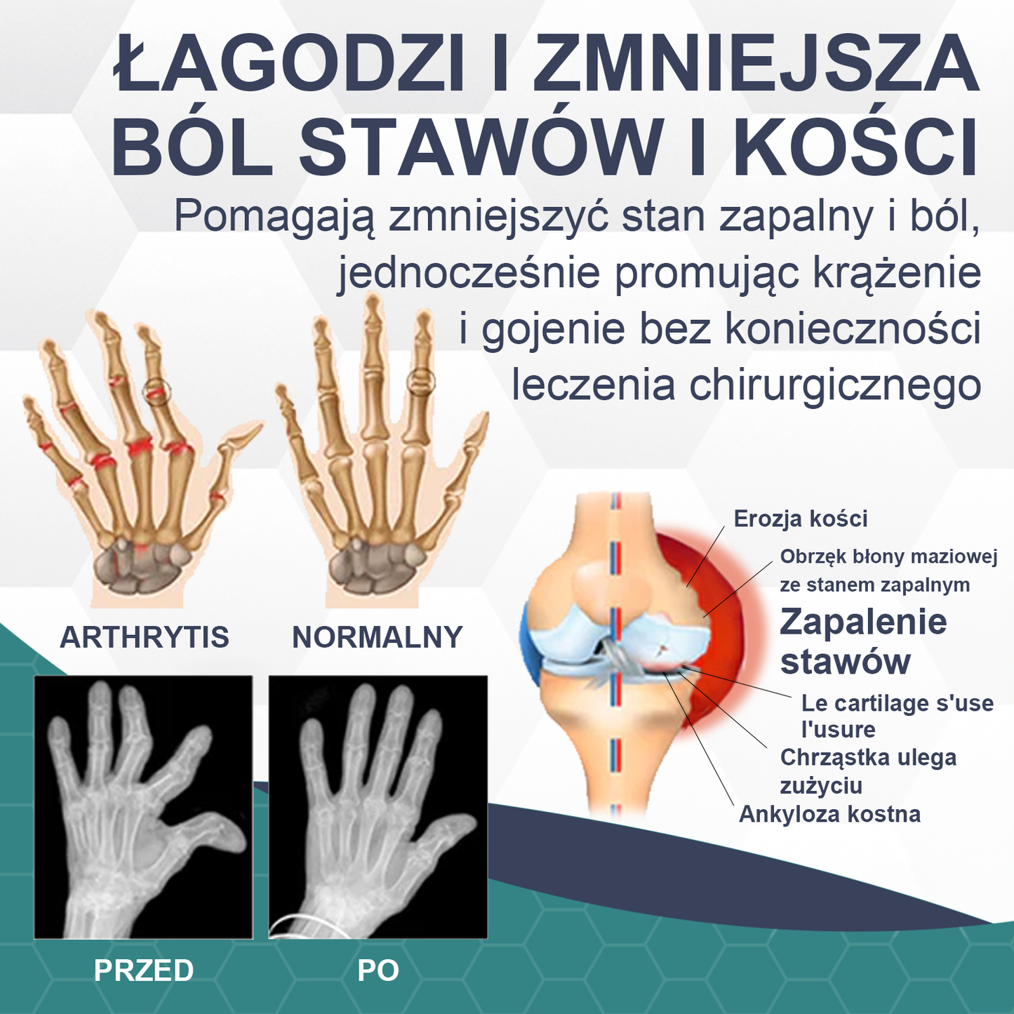 🌷🌷 IFMAGIC™ Krem gojący ból i kości z jadem pszczelim （Oferta ograniczona czasowo, trwa 30 minut）