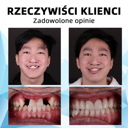 𝐁𝐢𝐤𝐞𝐧𝐝𝐚™🦷𝐙𝐞𝐬𝐭𝐚𝐰 𝐩𝐫𝐨𝐭𝐞𝐳 𝐝𝐞𝐧𝐭𝐲𝐬𝐭𝐲𝐜𝐳𝐧𝐲𝐜𝐡 𝐳 𝐬𝐢𝐥𝐢𝐤𝐨𝐧𝐮 (⏰𝐳𝐧𝐢ż𝐤𝐚 𝐨𝐠𝐫𝐚𝐧𝐢𝐜𝐳𝐨𝐧𝐚 𝐜𝐳𝐚𝐬𝐨𝐰𝐨, 𝐭𝐲𝐥𝐤𝐨 𝐩𝐫𝐳𝐞𝐳 𝟑𝟎 𝐦𝐢𝐧𝐮𝐭👨‍⚕️)👨‍⚕️