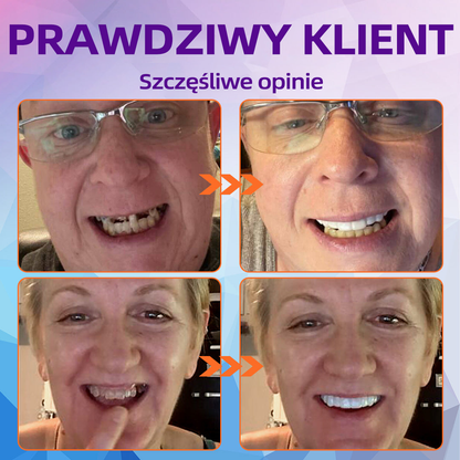 𝐁𝐢𝐤𝐞𝐧𝐝𝐚™ RELINOWANIE SILIKONOWE ZESTAW PROTEZ ( najniższa cena online)💎