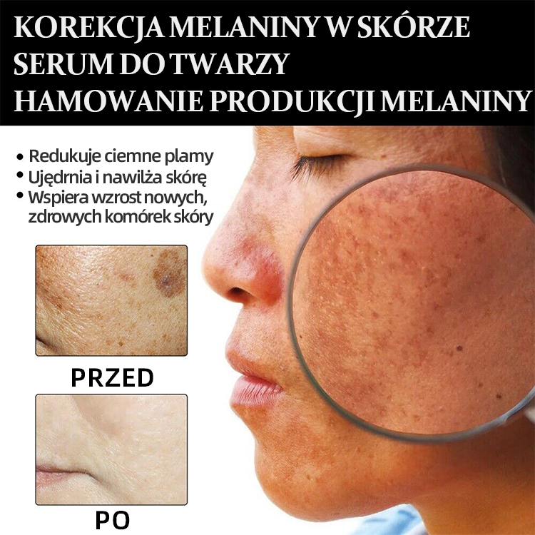 ✨Szybki Usuwacz Przebarwień - NESLEMY™ Korekcyjne Serum do Twarzy na Melaninę💧