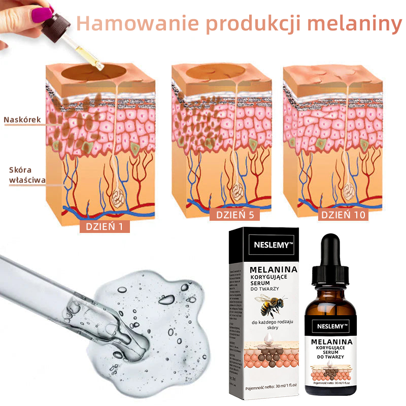 ✨Szybki Usuwacz Przebarwień - NESLEMY™ Korekcyjne Serum do Twarzy na Melaninę💧