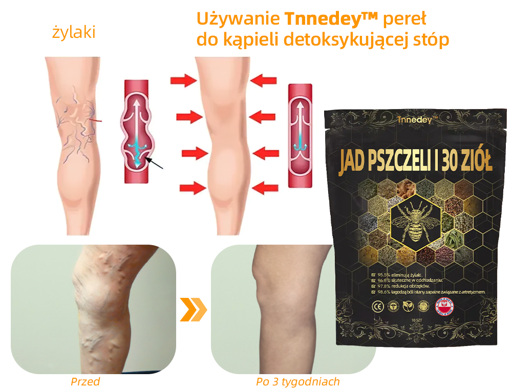 Tnnedey® Kulek do Kąpieli Stóp z jad pszczeli & 30 Ziołami do Modelowania Ciała - Polecane przez Polską Akademię Limfologiczną (PAL)✨